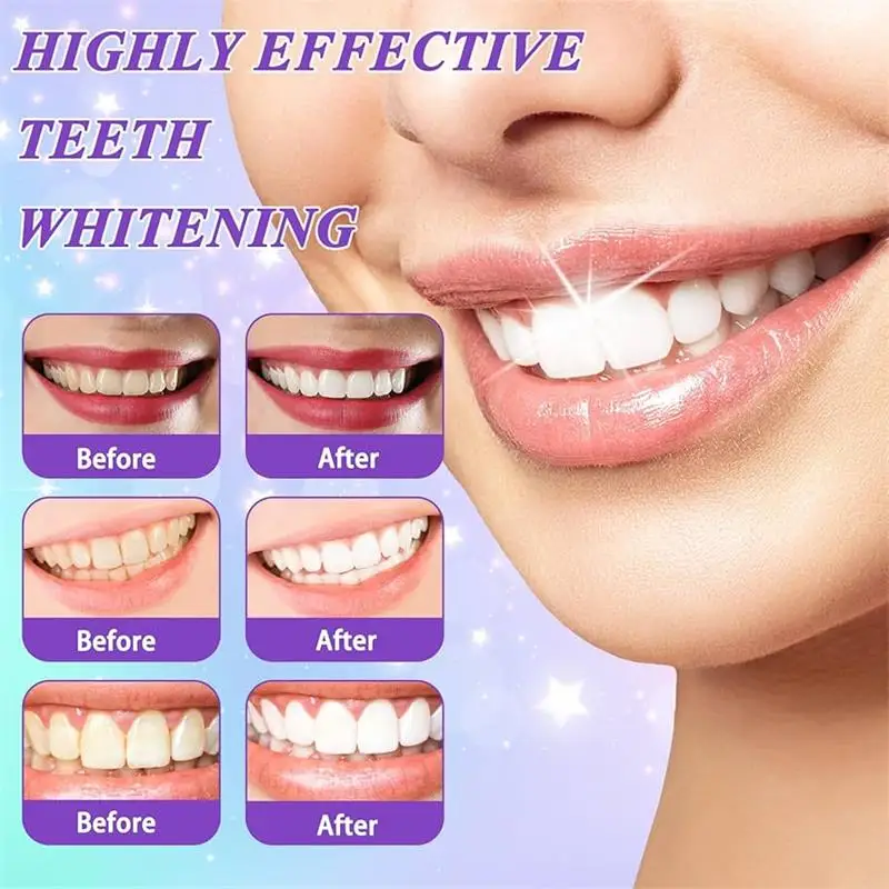 ยาสีฟันมูสฟอกสีฟัน 9D สีม่วง ข - Teeth Whitening Natural บทวิจารณ์และราคา