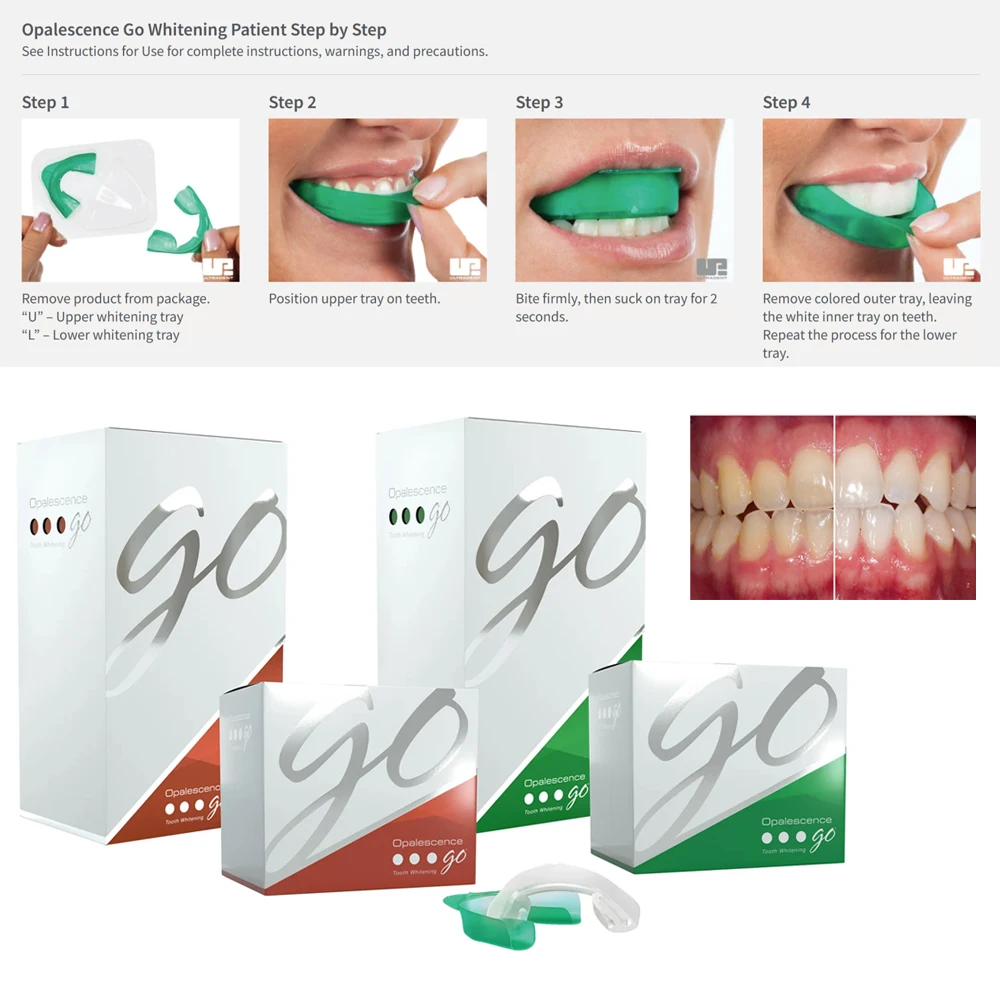 

Opalescence Go Teeth Whitening Trays Prefilled At Home Take Patient Kit American Ultradent 15% 15 Percent HP Gel Professional