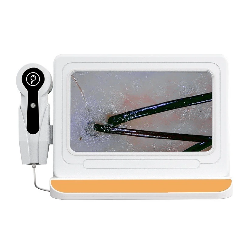 Skin Tester Scalp Hair Follicles