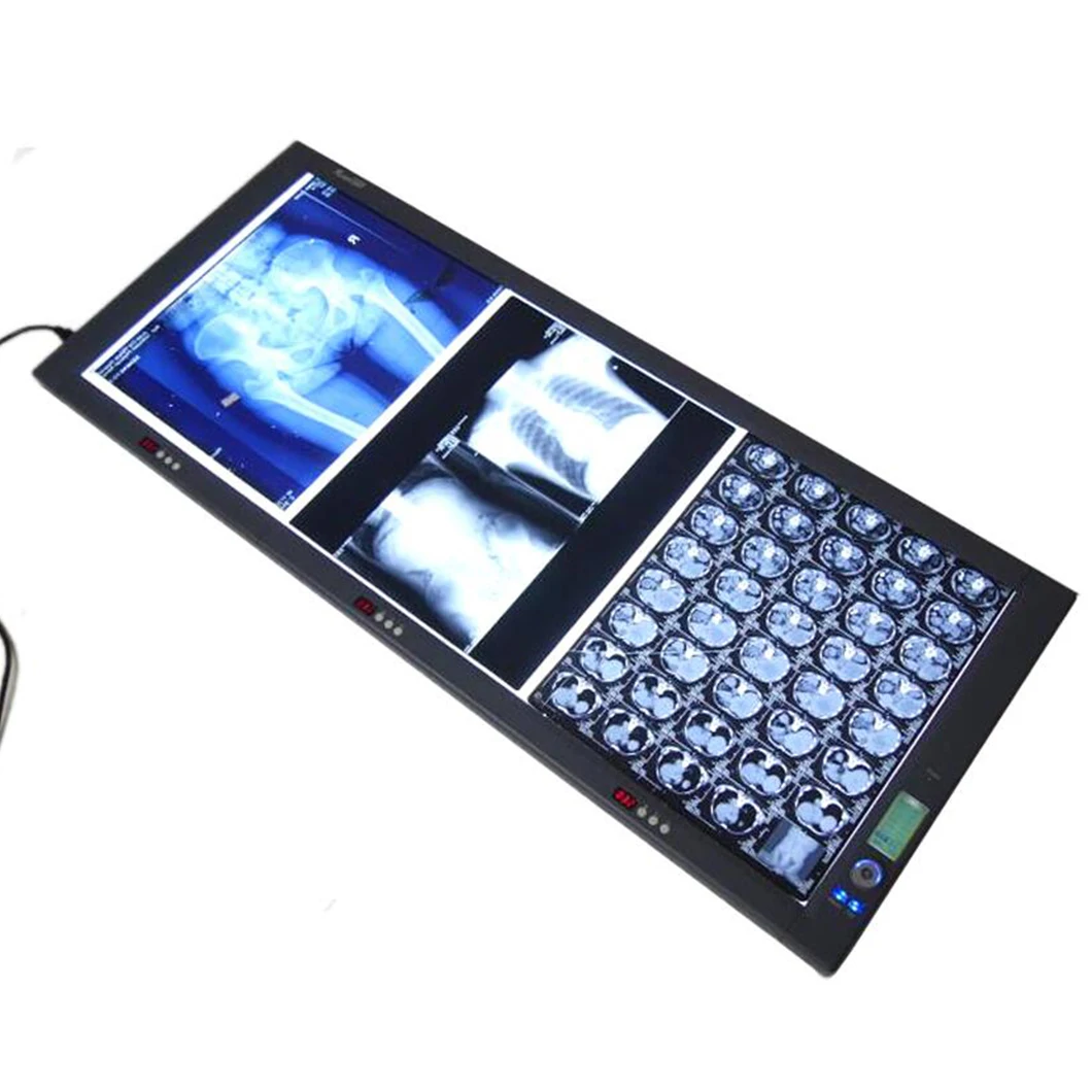 

FY ZG-3C LED Medical X-ray Film Viewer industrial x-ray film viewer X Ray Film Viewer