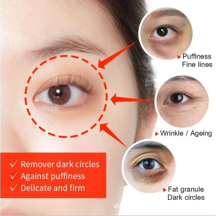 Fat Granules Removal Eye Serum Anti Dark Circle Eye Bags Fade Fine Line Essence Anti-Puffiness Moisturizing Skin Care Products