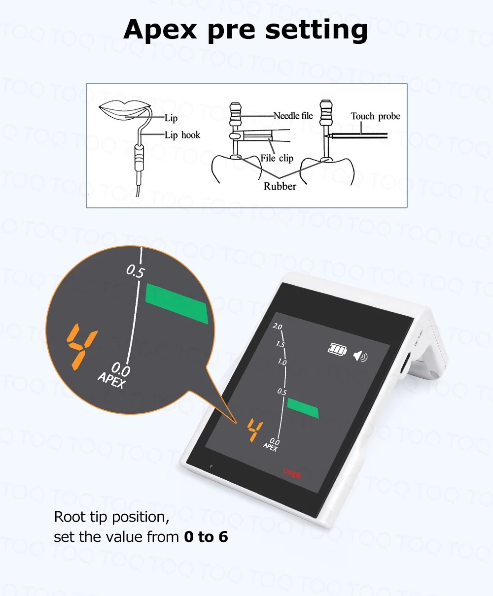 Mini Dental Rechargeable Apex Locator with Pre-setting New Function Root Canal Measurement Oral Treatment Endodontic Equipment