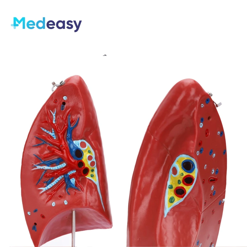 Detachable Human Anatomy Lung Anatomical Model