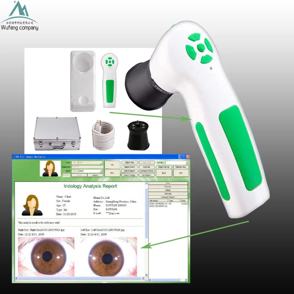 Wufeng WF-9822U Multi-Functional Iridology Camera Body Health Detector CE Certified USB Rechargeable Electricity Class II