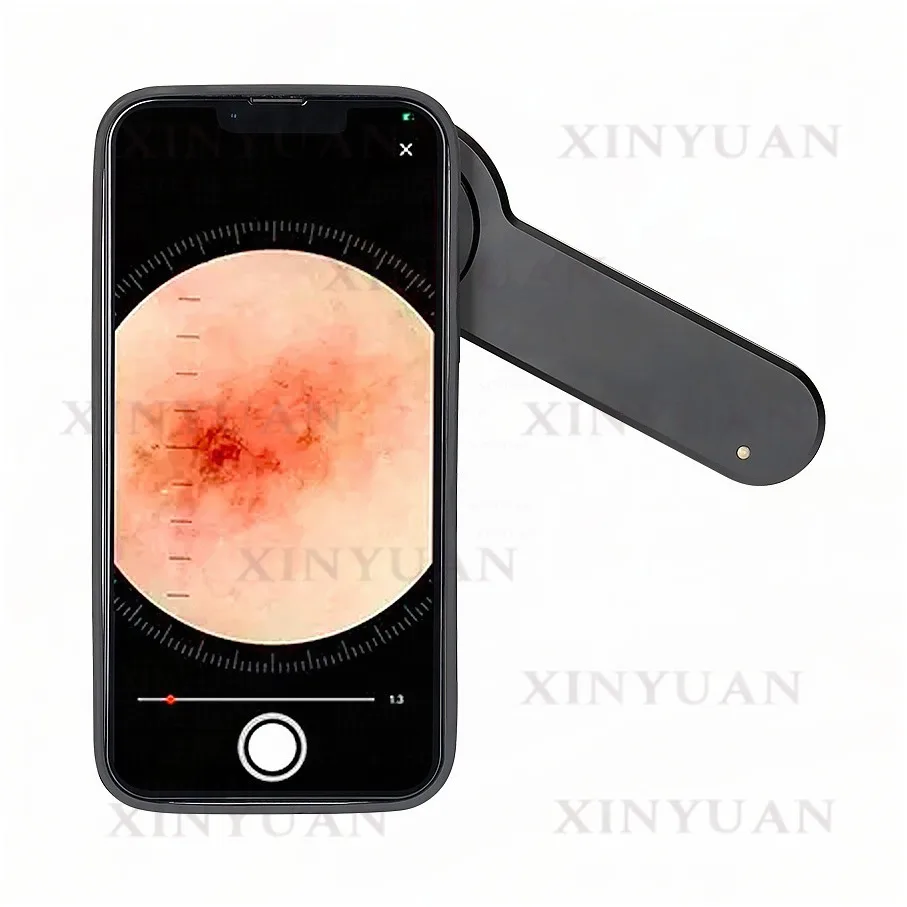 Dermatoscope 10x Magnification Polarized 3-Lens Set All-Glass Optics Aluminum Alloy
