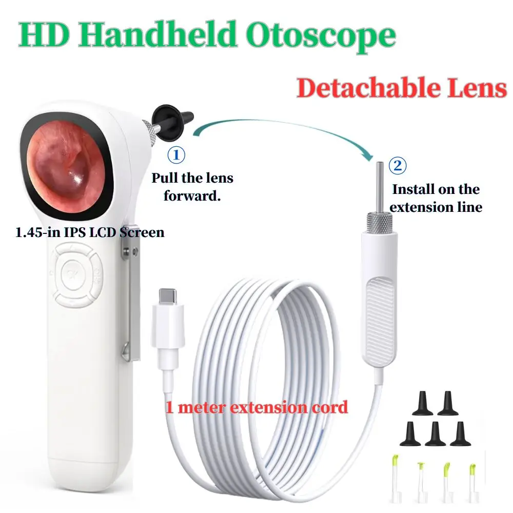 Teslong 3.9mm HD Digital Otoscope IPS Screen, Ear Scope Otoscope with Camera Ear Wax Removal Camera Applicable to clinics