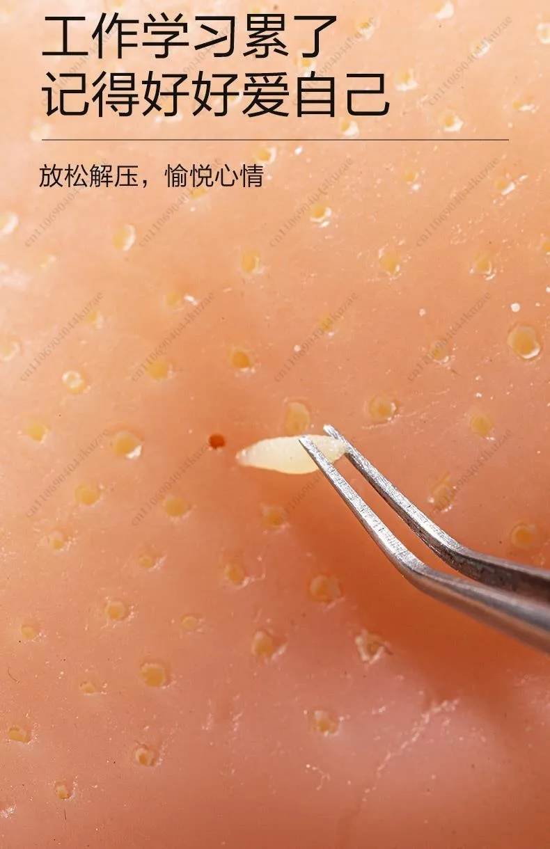 Simulator for Stress Relief Pimple Popper Toy - Realistic Blackhead Remover