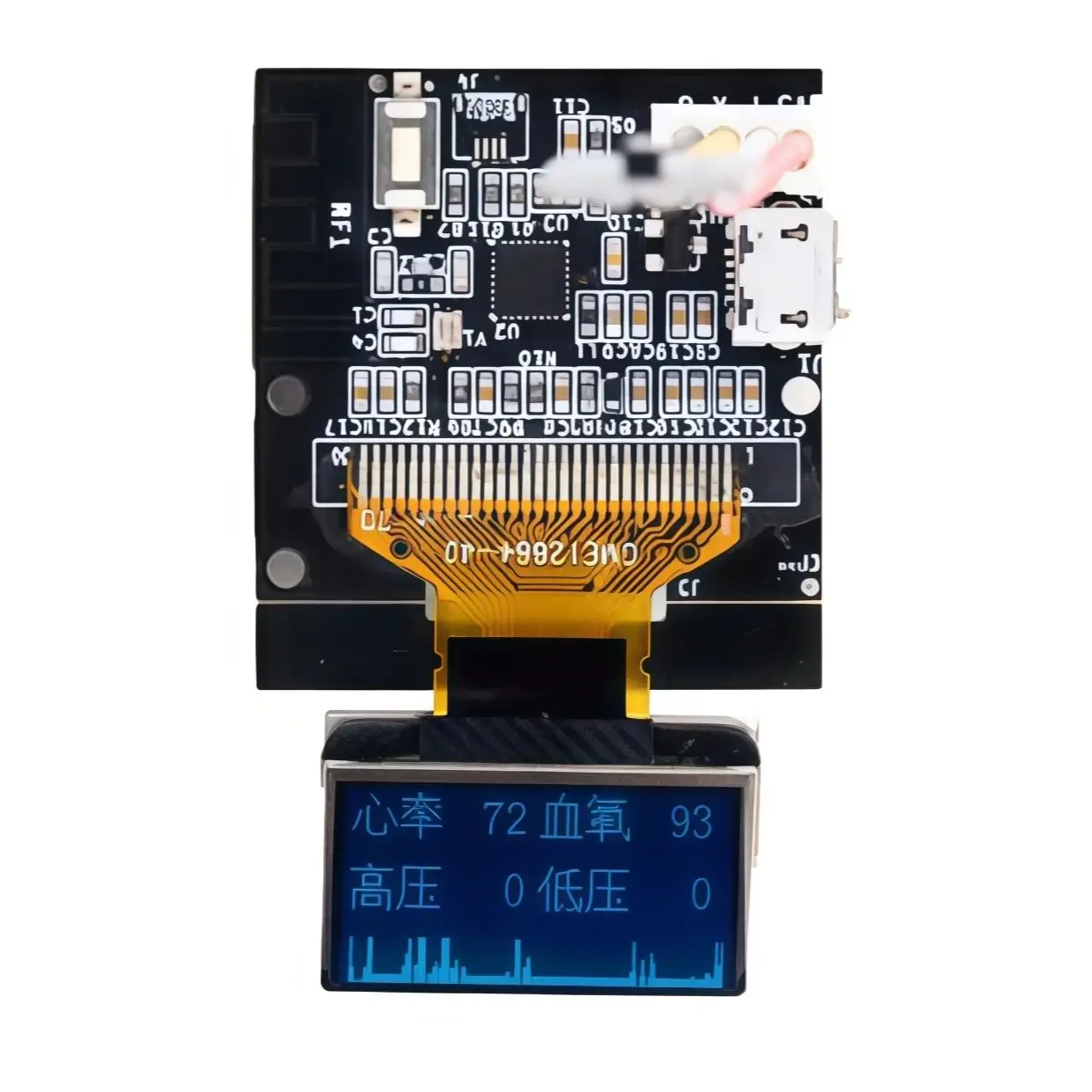 MKS OLED Display Kit: Real-time display of heart rate, blood oxygen, blood pressure, and respiratory rate.
