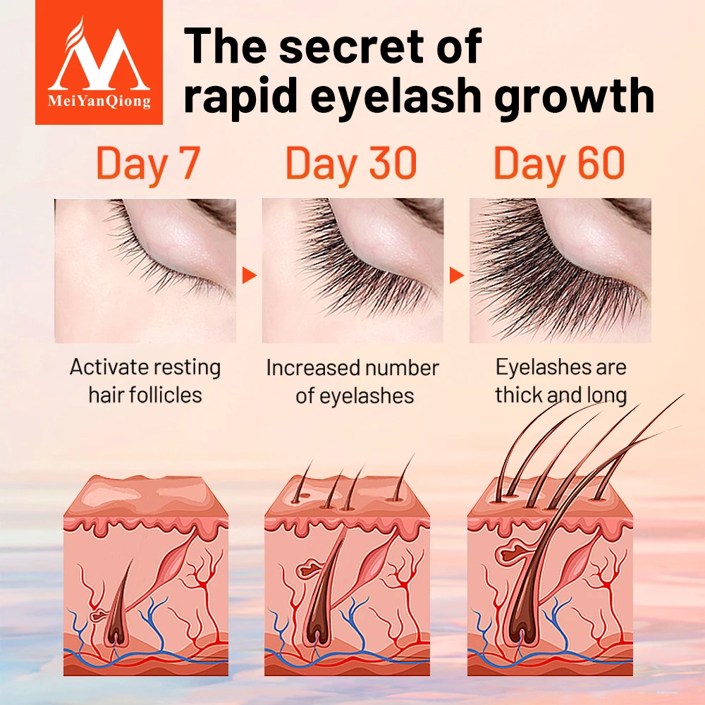 MeiYanQiong Eyelash Growth อาหาร Liquid Eye ตัวต่อขนตาหนายาวความยาว Strong Growth Eyelash Eye Care 10Ml