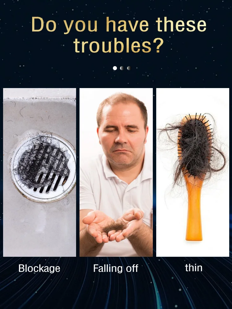 شحن مجاني، استيقظ بصيلات الشعر أثناء النوم وجعل الجزء العلوي من الرأس أكثر فخامةً