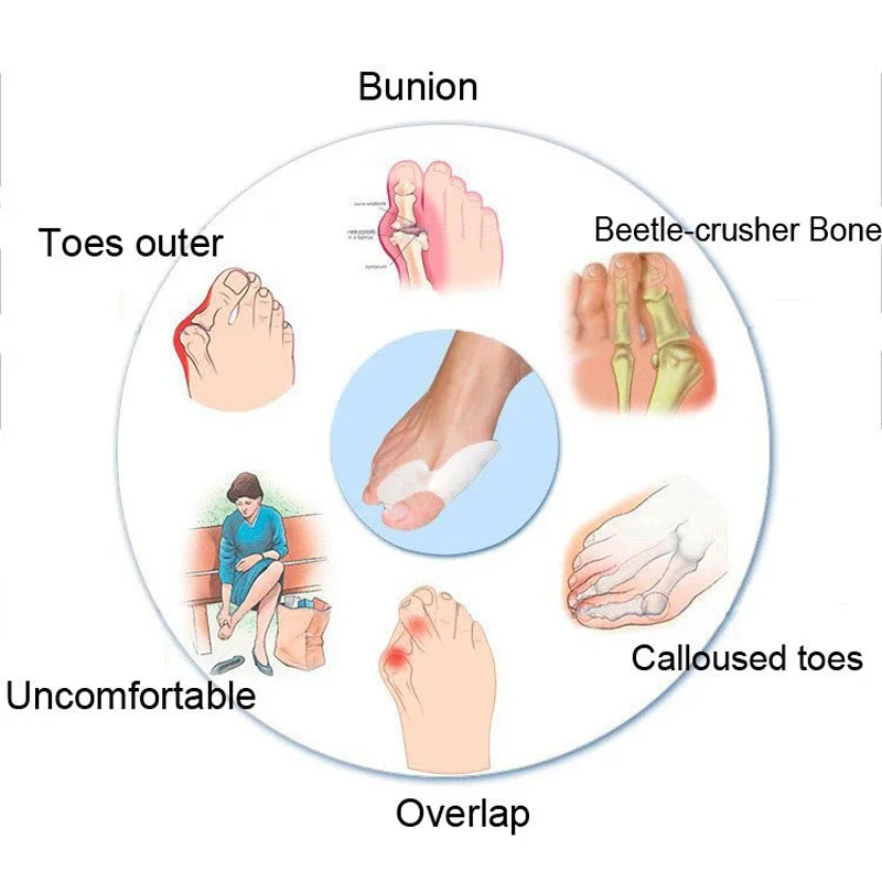 Corrector de pulgar de Gel de silicona, separador Protector del dedo pequeño, alisador de dedos Valgus, herramienta de almohadillas de alivio para el cuidado de los pies