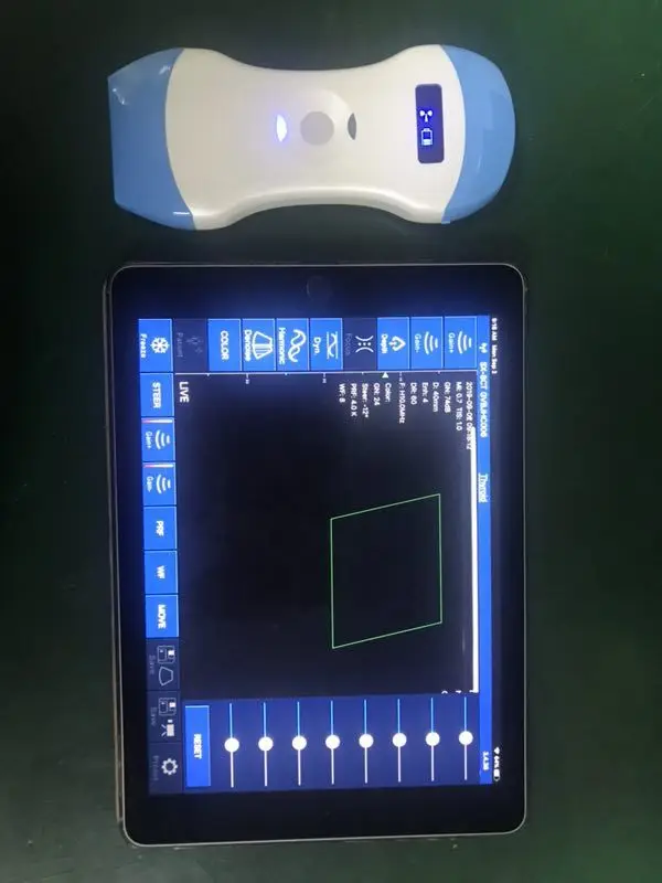 Microconvex Wireless Mini Ultrasound Scanner Double head with linear and curve type