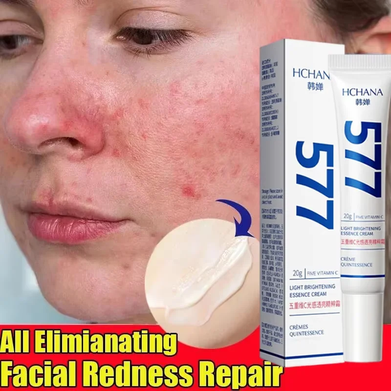 Instant Facial Redness Repair Cream Soothing Red Blood Rosacea Treatment Improve Sensitive Skin Anti Redness Skin Care Cosmetics