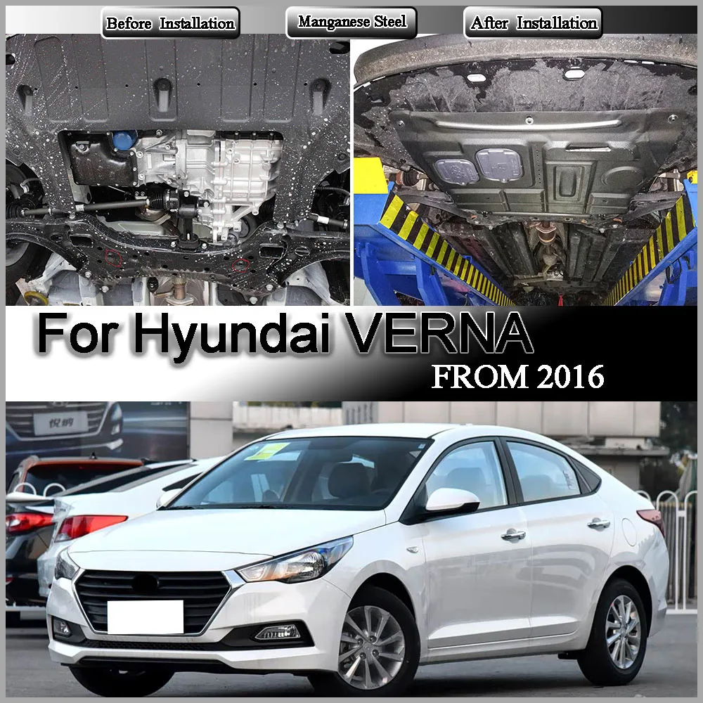 Engine Base Guard Shield Splash Mud Flap Gear Box Under Fender Cover Board Plate Accessories For Hyundai VERNA 2016 1.4L 1.6L