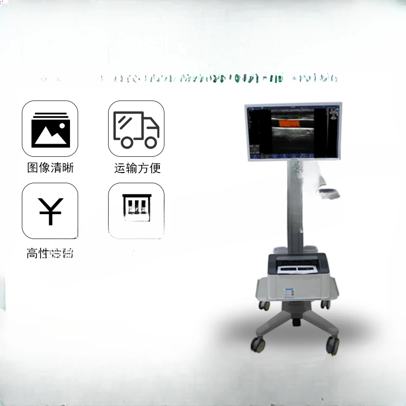 T-cart touch screen color ultrasound is convenient for mobile intelligent operation clinics and hospitals