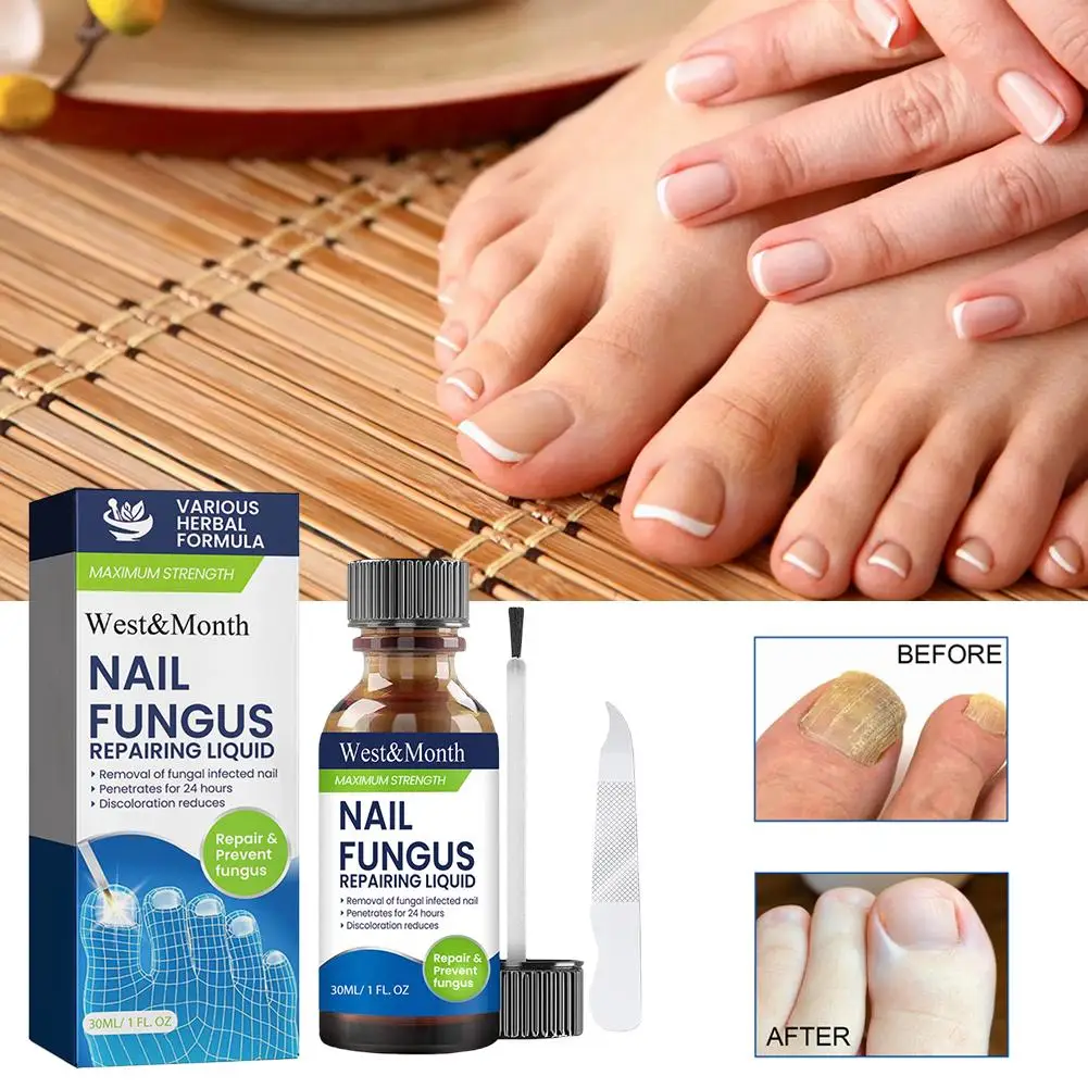 7 Days Nail Repair Serum Nail Fungal Removal Onychomycosis Paronychia Treatment Nail Softener Ingrown Toenail Care Essence Oil view 3
