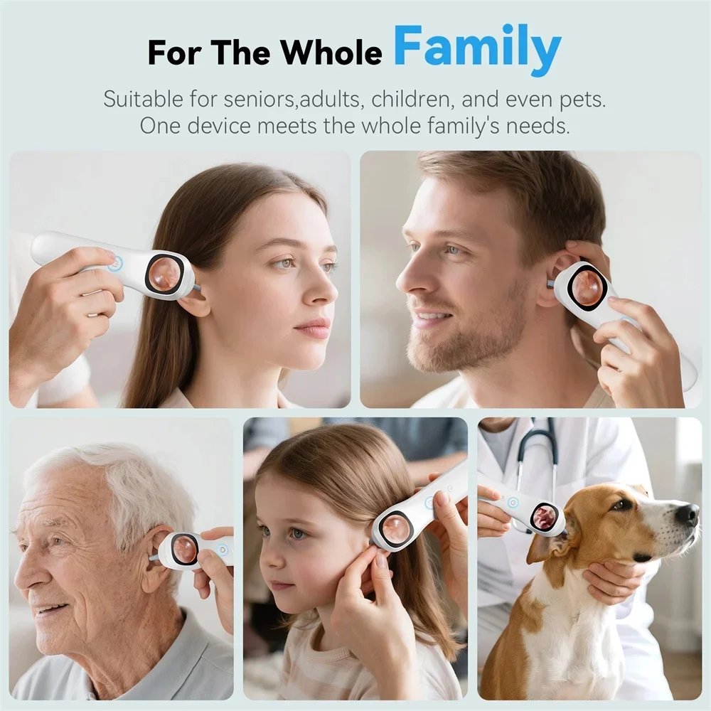 Digital Otoscope with IPS Screen, 1080P HD Smart Visual Ear Camera, Ear Scope Otoscope Camera , Ear Wax Removal Tool Camera