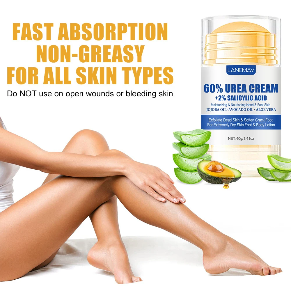 Cracked Foot Cream 60% Urea Aloe Vera Ultra-hydrating Softening Dry Cracked Feet Gentle Exfoliation Autumn Winter Foot Care