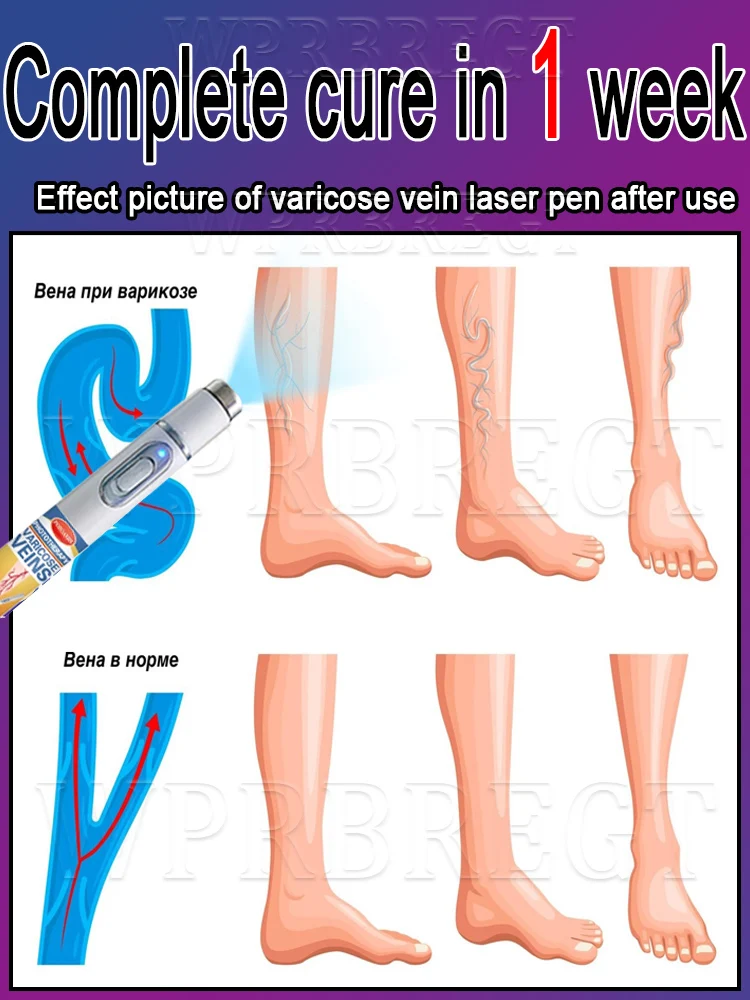 Bescherm uw gezondheid, laseraanwijzer