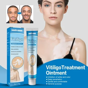 20g Vitiligo temizleme kremi Hızlı Etkili Lökoplaki Vitiligo Onarım Kremi Doğal Beyaz Nokta Yatıştırıcı Krem Merhem Sağlık