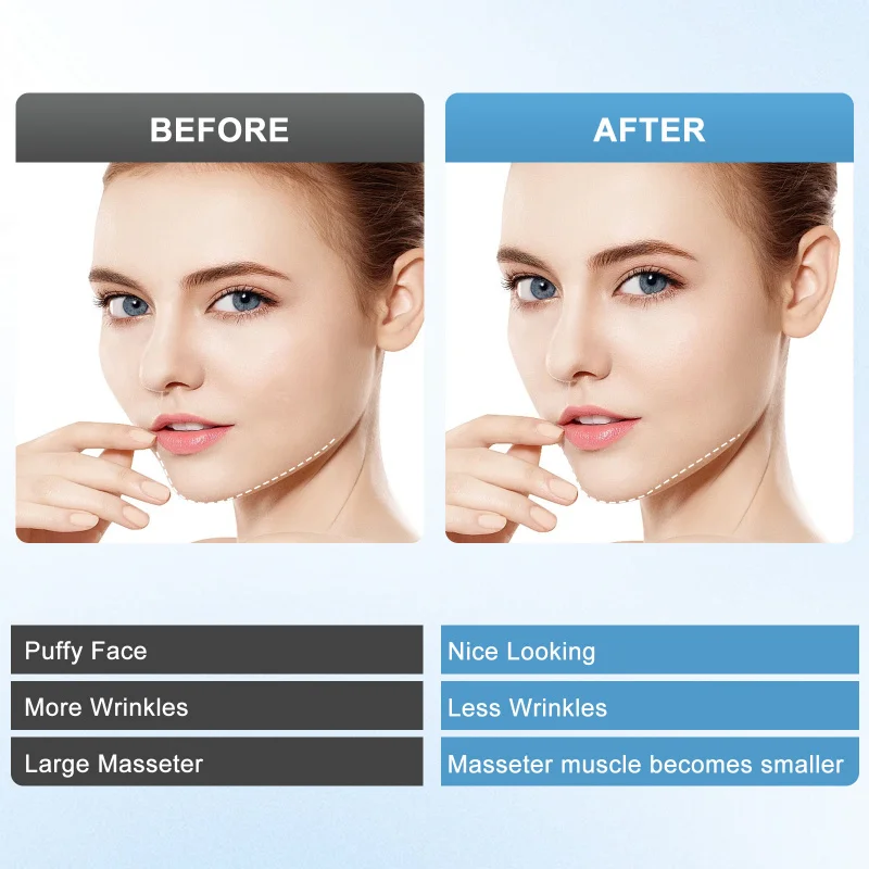 EMS مكركرنت الكهربائية الوجه التخسيس الجمال الفوتون جهاز تجديد الجلد رفع سليم مدلك العضلات الدهون Bu #5