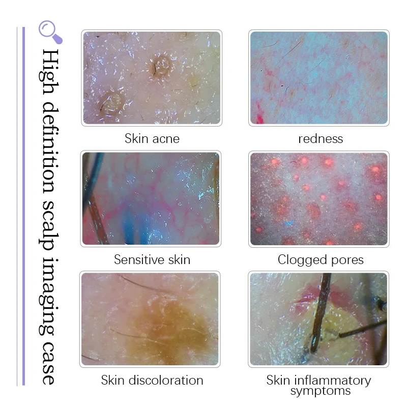 15 في 1 هيدرا الأكسجين جهاز للعناية بالوجه هيدرو تقشير المياه تشديد التنظيف العميق آلة إزالة الرؤوس السوداء مع كاشف الجلد #6