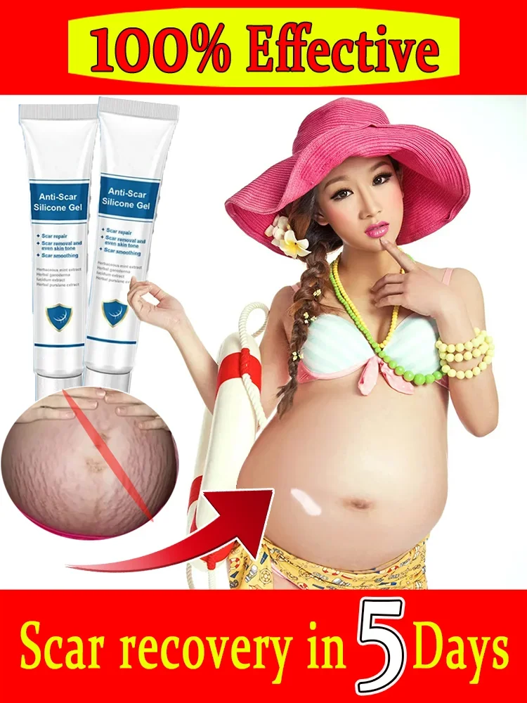 

Maternity Cream Improves Elasticity Skin Care Gentle After Pregnancy Stretch Marks Removal Stretch Marks Highly Effective