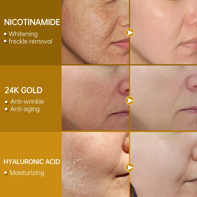 Niacinamide Face Serum Hyaluronic Acid 24K Gold Moisturizing Lightening Facial Fade Melanin Brighten Skin Care