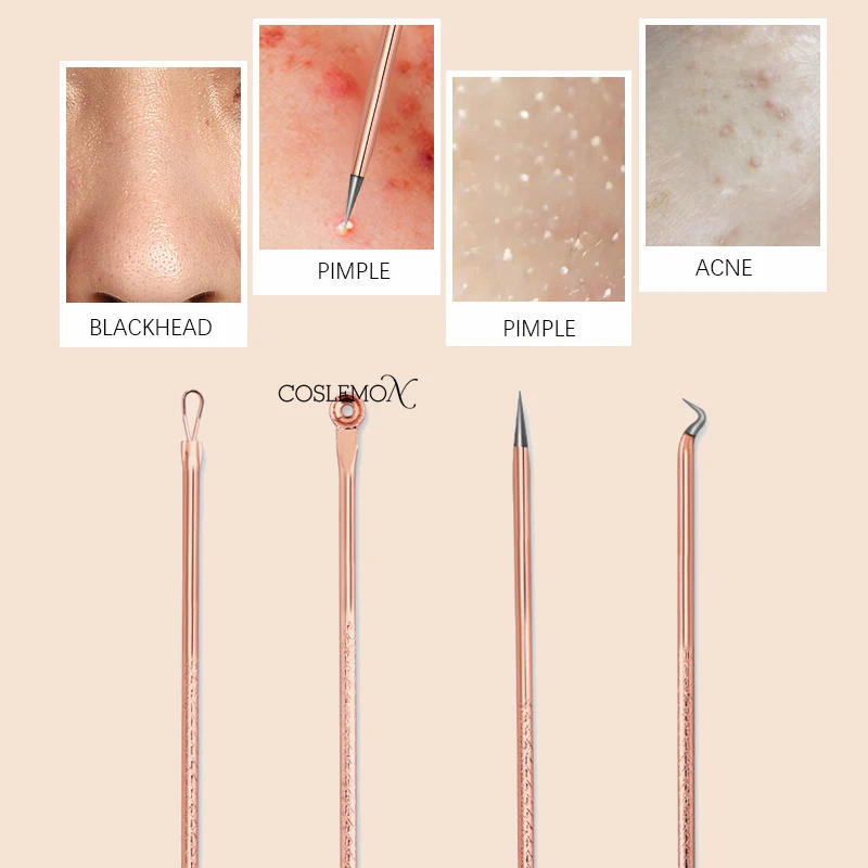 4 stks/set Comedondrukker Squeeze Acne Naald Pincet Rvs Spot Extractor Professionele Facial Gezicht Huidverzorging Tool