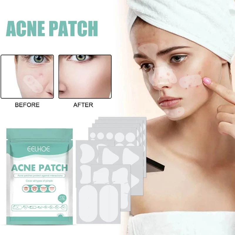 

132pcs Acne Spot Treatment Patch Skin Care ,blemish Spot Facial Mask ,hydrocolloid Blackhead Remover,acne Pimple Patches Sticker