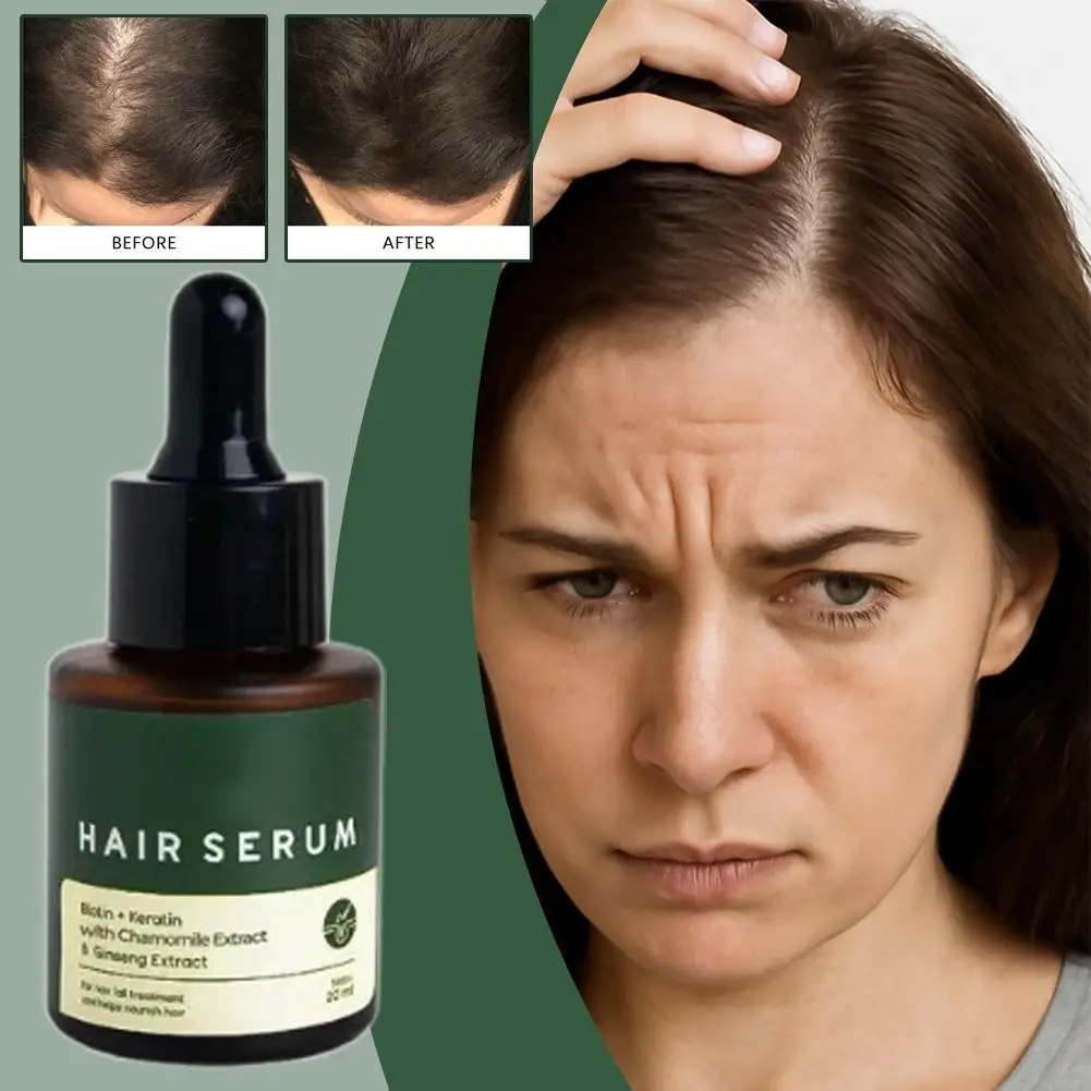 مغذي للعناية بالشعر، ظروف الزيوت العطرية، شعر فروة الرأس يقلل من التجعد، 20 مل، جذور الشعر W8G4 #2