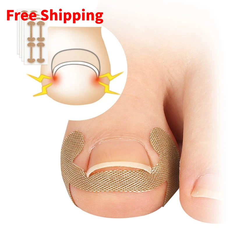 4Pcs/8Pcs/12Pcs Nail Correction Stickers Ingrown Toenail Corrector Patches Treatment Recover Corrector Foot Pedicure Care Tool