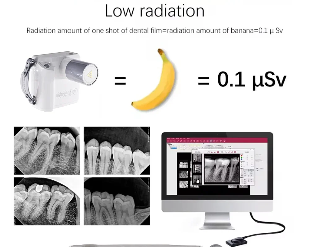 Wireless Portable70kV Dental X-ray Camera RAY98P Medical Apparatus Clinic Digital Camera  Dentist X Ray Machine