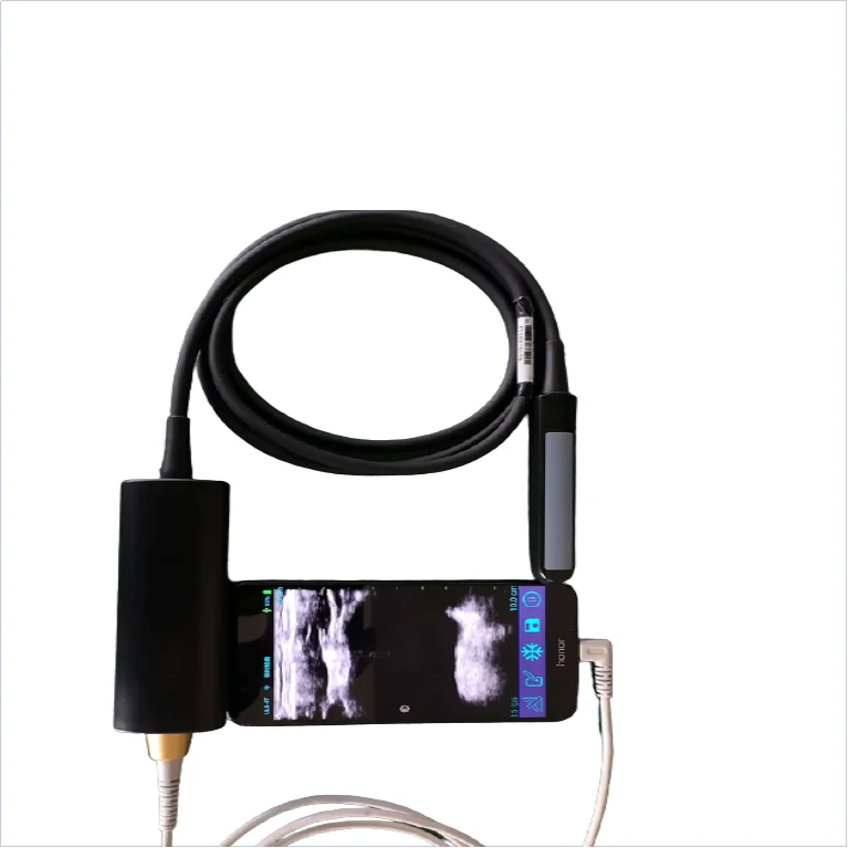 Medical Handheld Portable Rectal USB Ultrasound Probe Type C Ultrasonic Transducer Mini Sonar Ultrasound Scanner