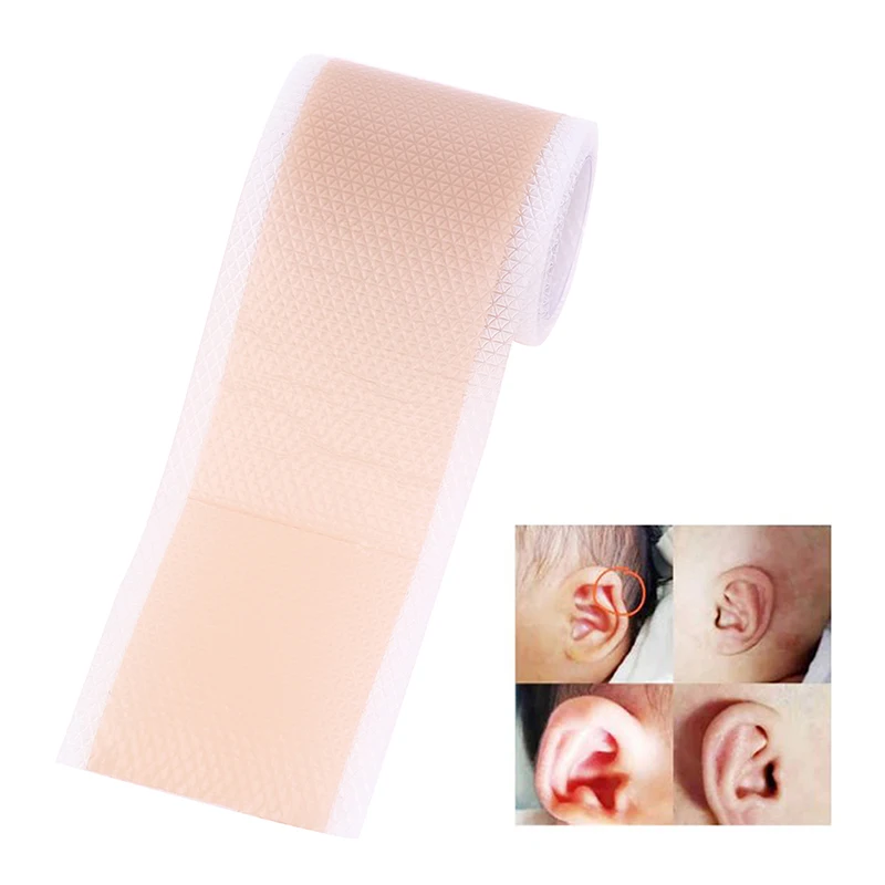 New Ear Correction Tape Ear Cleaner Tool Kit Newborn Baby Ear Aesthetic Correctors Kids Infant Protruding Ear Patch Stickers`~