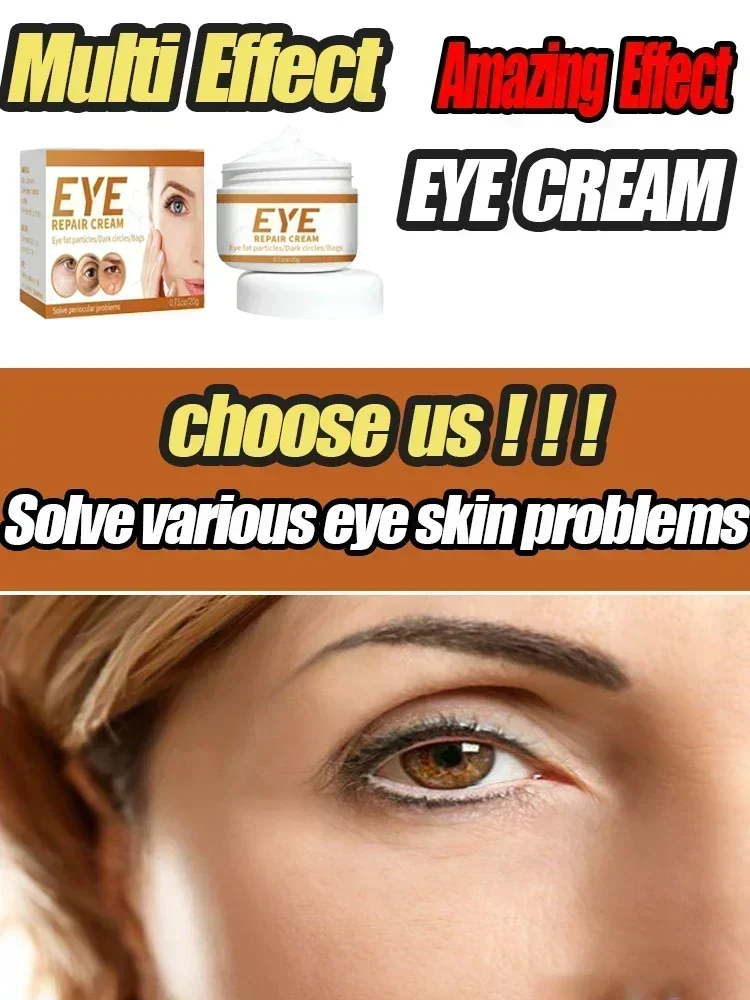 Crème éclaircissante et hydratante pour les yeux, élimine les poches sous les yeux, les rides fines, les cernes, les poches sous les yeux, les soins de la peau blanchissants