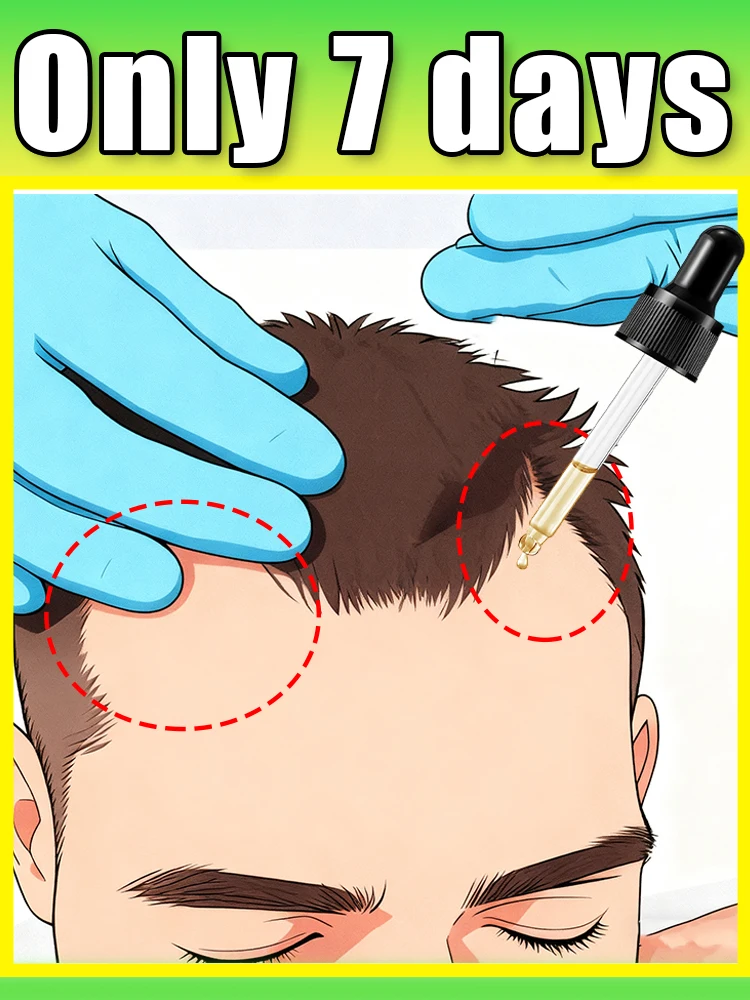 

say goodbye to the troubles of wide hair parting and thinning hair
