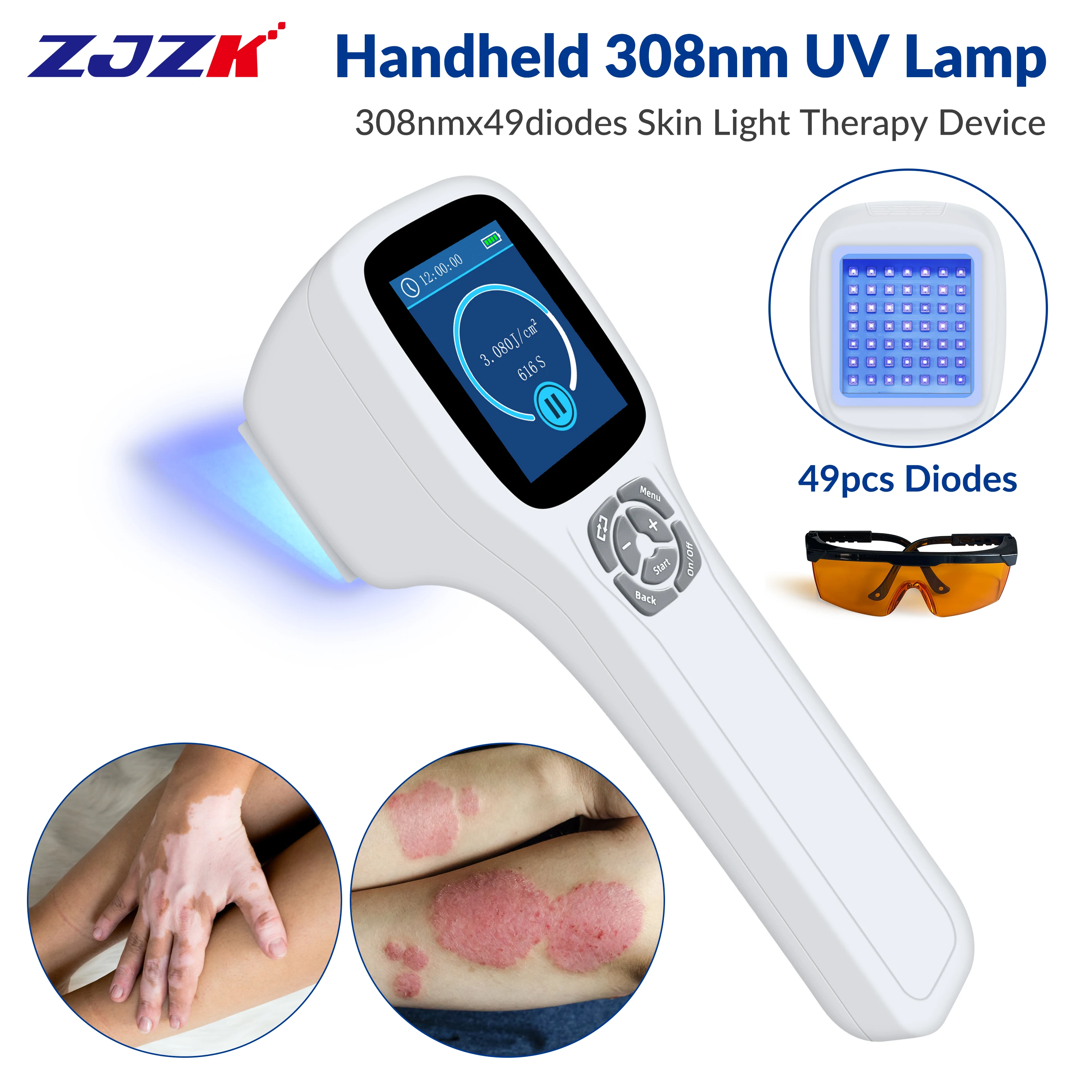 

ZJZK Blue Light Skin Treatment At Home Ultraviolet UV Light Therapy 308nmx49diodes Eczema Before And After Nodular Pruritus