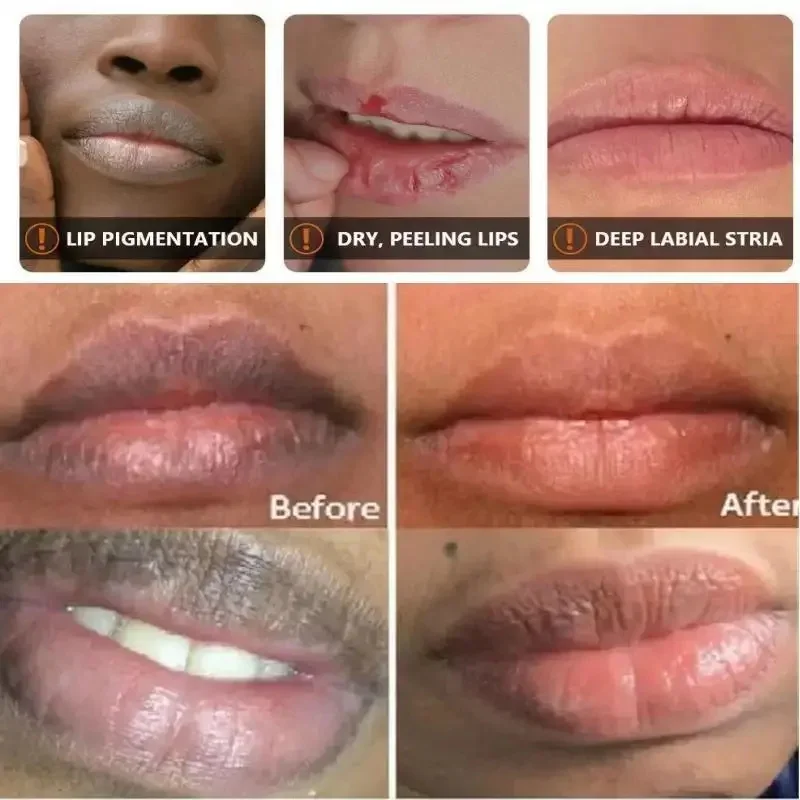 Verwijder Donkere Lippenbalsem Verlichting Melanine Masker Gloss Olie Exfoliërende Schone Moisturizer Koreaanse Verzorgingsproducten Make-Up Schoonheid Gezondheid