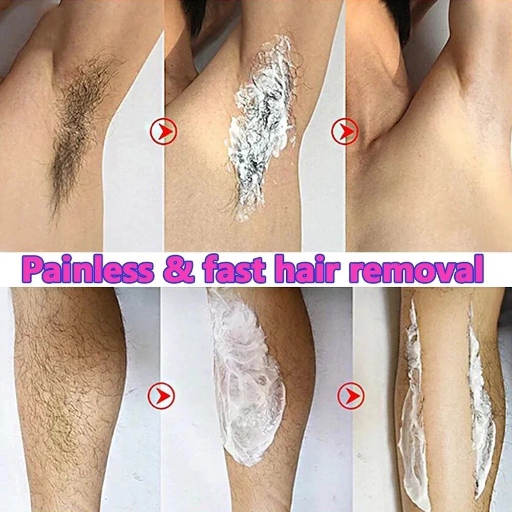 Creme de depilação rápida para homens e mulheres Inibidor indolor do crescimento do cabelo Axila do braço Depilatório permanente das pernas Cuidados