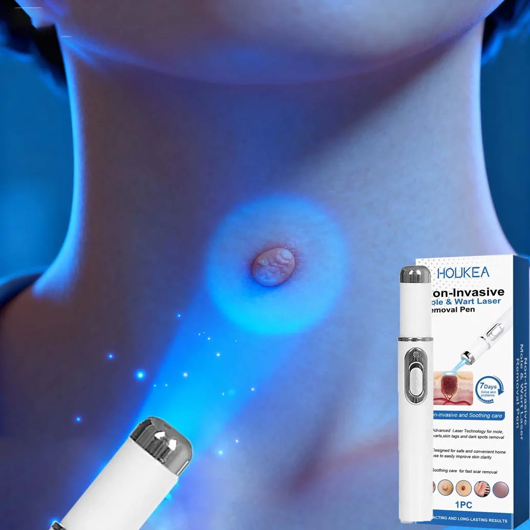 

4-глубокая стерилизация, лазерная ручка для лечения плоских бородавок, кондилома, алюмина и различных бородавок, безболезненное физическое удаление бородавок