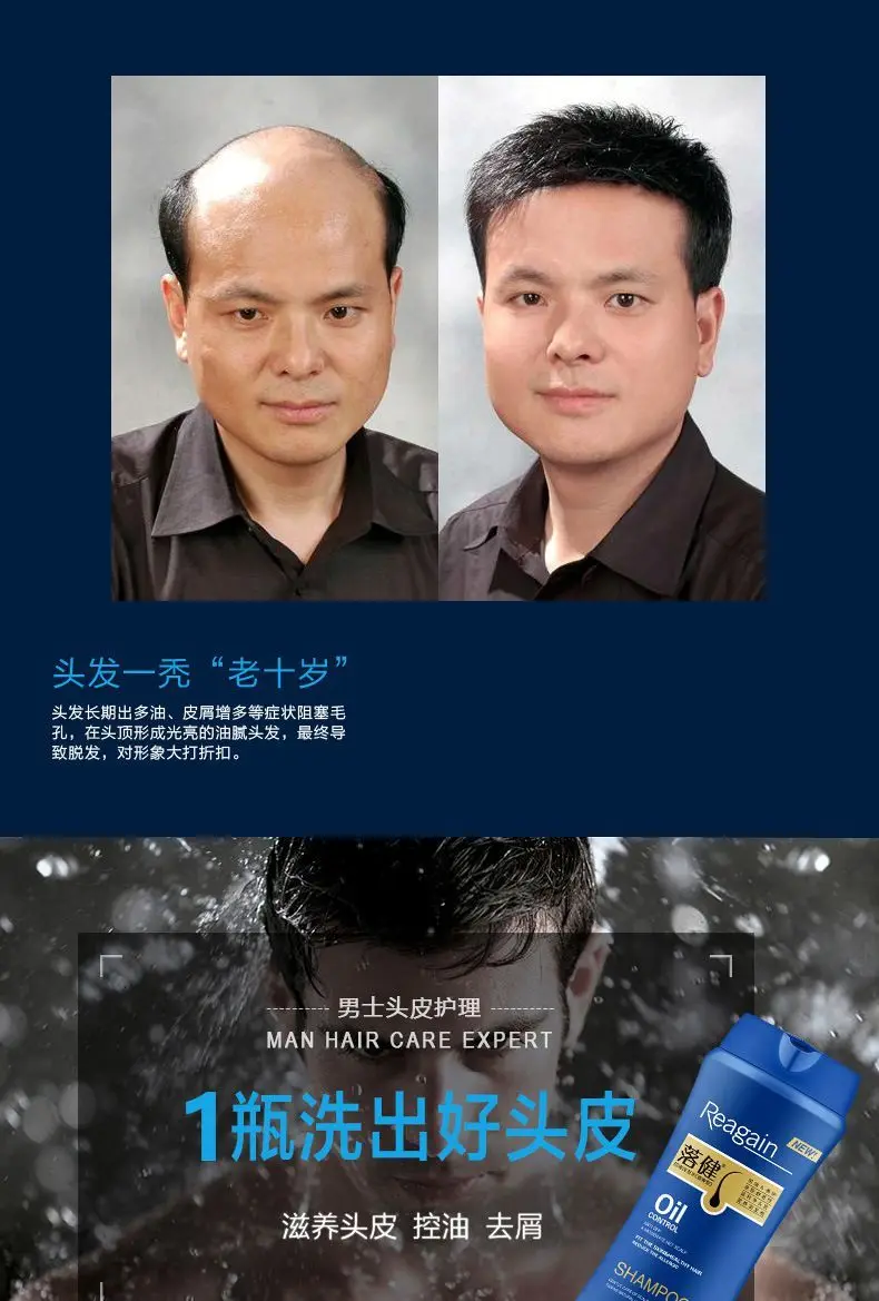 Rogaine Scalp Care Shampoo - Polygonum Multiflorum Extract & Biotin for Thinning Hair, Dandruff Control Moisturizing Shampoo