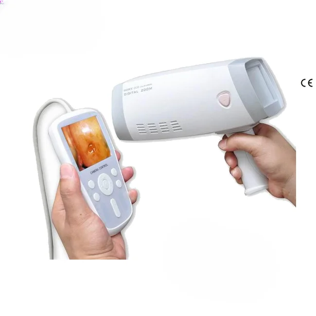 Handheld Gynecology Video Camera Colposcopy Machine SUN-200Y