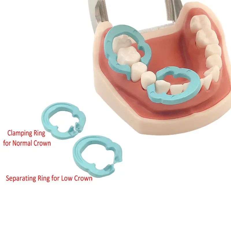 

4 шт./партия, стоматологические кольца из смолы