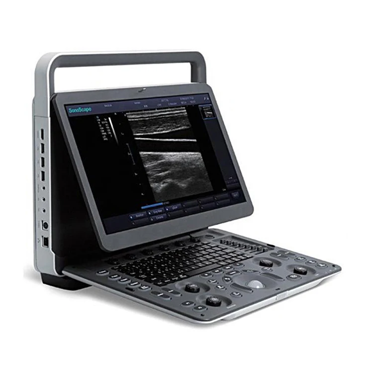 Best selling E2 ecografo sonoscape ultrasound machine portable  SonoScape portable ultrasound machine