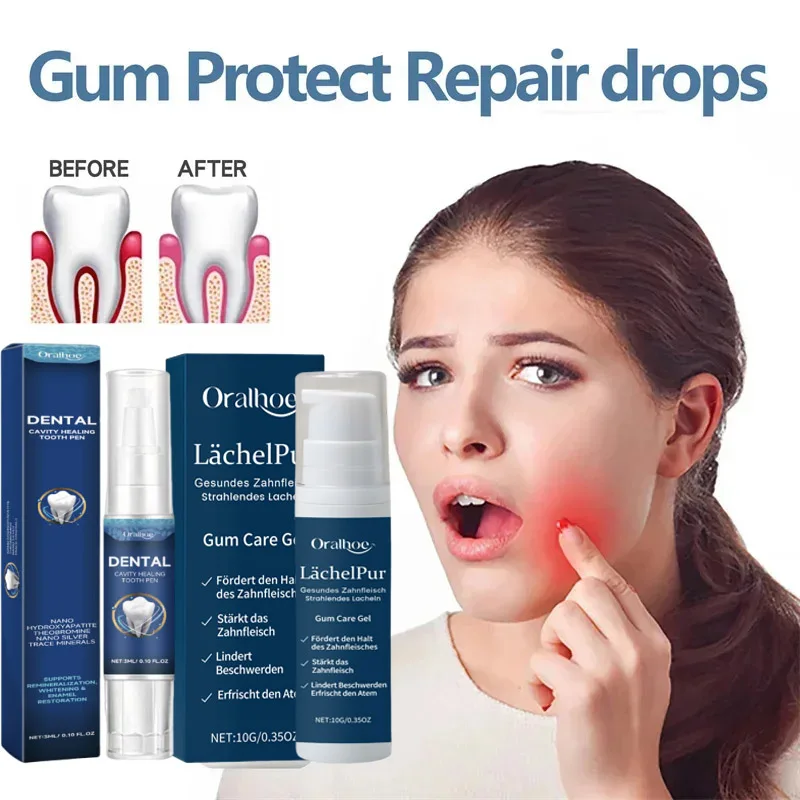 

Gums Repair Gel Effectively Relieve Tooth Allergy Dental Caries Tooth Cleaning Toothpaste Relieve Tooth Damage Serum