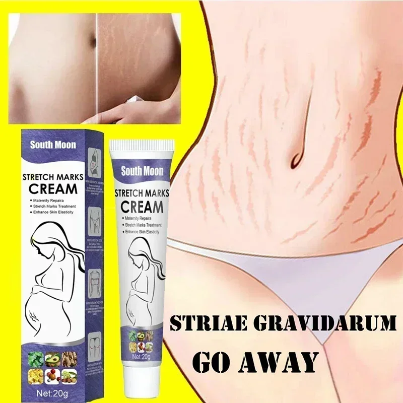 

Stretch Mark Permanent Remover Stretch Mark Removal Cream Scar Removal