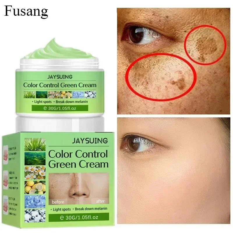 Face Fast Remove Spots Cream Whitening Skin Brightening Cream Women Fade Melasma Anti-aging Serum Lightening Freckles Products