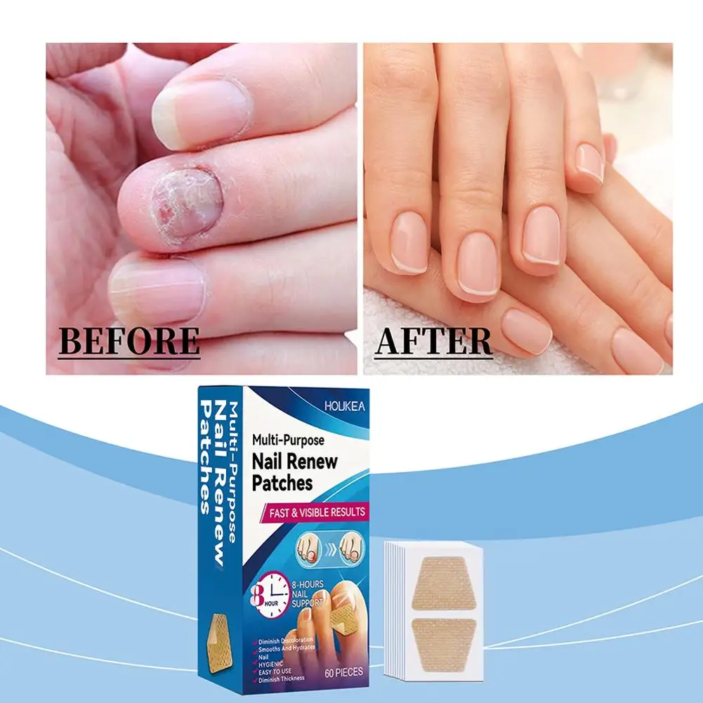 Patch champignon pour ongles des pieds, 60 pièces, patchs de réparation imperméables pour ongles incarnés, autocollants de Correction pour ongles décolorés et endommagés