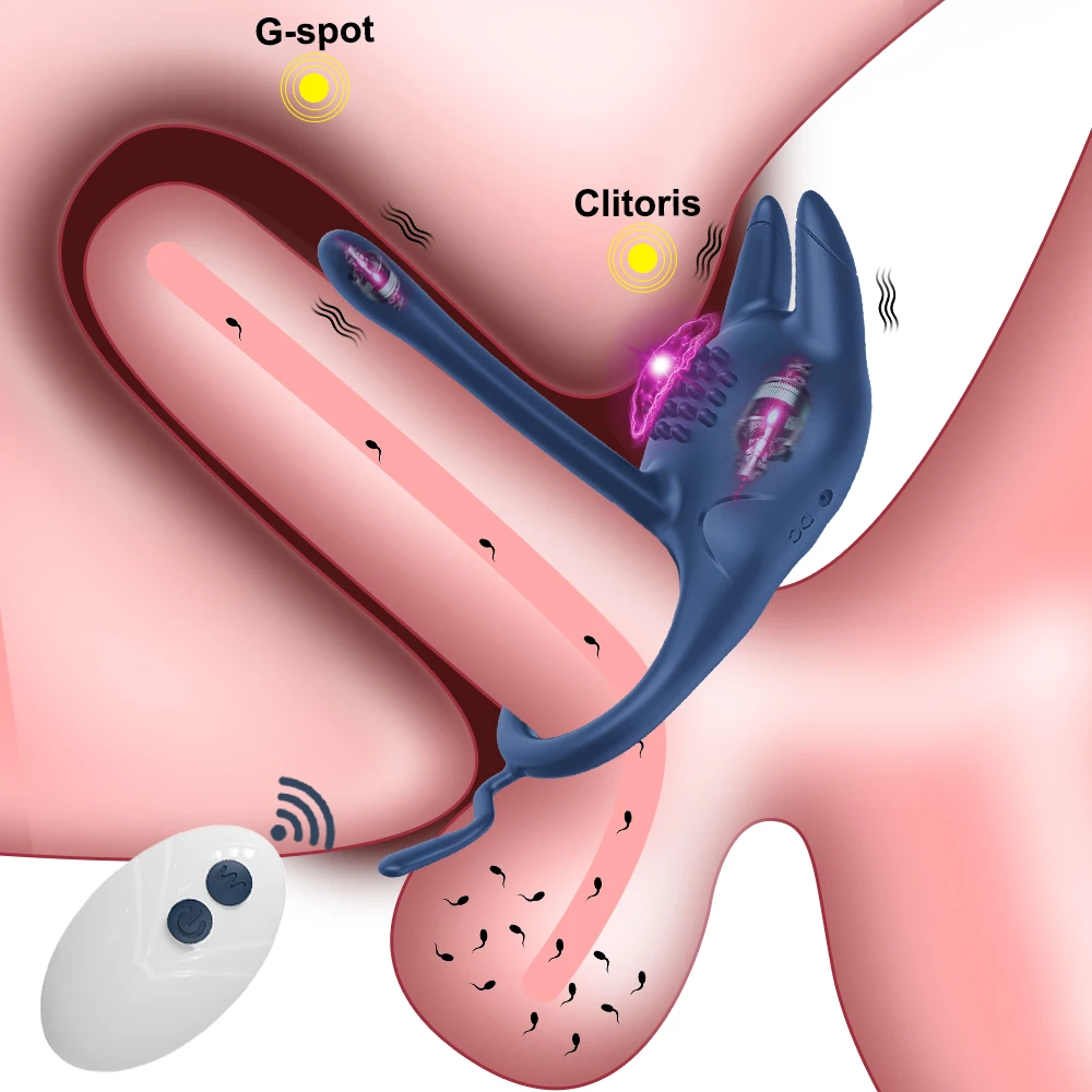 男性用のリモコン付きペニスリング,コックバイブレーター,クリトリス刺激の遅延,侵入,カップル用の大人のおもちゃ